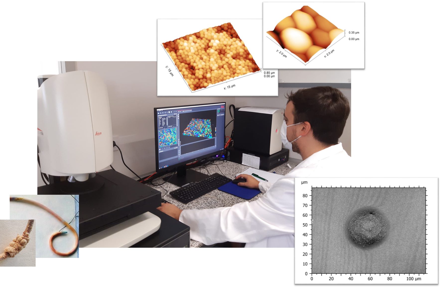 Investigador del Grupo trabajando sobre una sonda contaminada por una Colonia de bacterias estafilococos aureus.